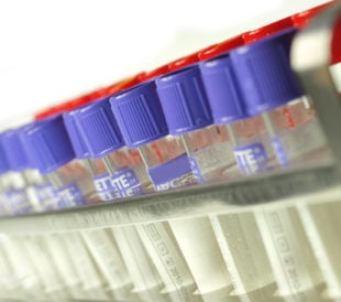 Test tubes filled with clear liquid. Image: Jag_cz/Shutterstock.com