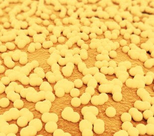 MRSA. Image: Jezper/Shutterstock.com