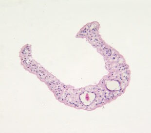 Microphotograph of human parasite Schistosoma mansonii which causes tropical diseases schistosomiasis, transverse section through male and female parasites in copulation, light microscopy, X120. Image: Kateryna Kon/shutterstock.com.