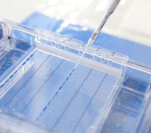 Man loading a sample into a gel for electrophoresis. Image: phloxii/Shutterstock.com.