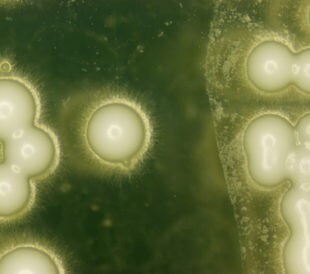 Yeast under the microscope. Image: PIYAPONG THONGDUMHYU/Shutterstock.com.