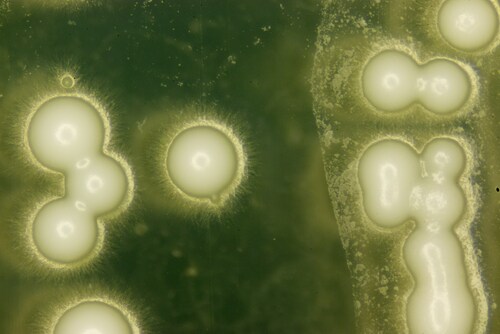 Yeast under the microscope. Image: PIYAPONG THONGDUMHYU/Shutterstock.com.