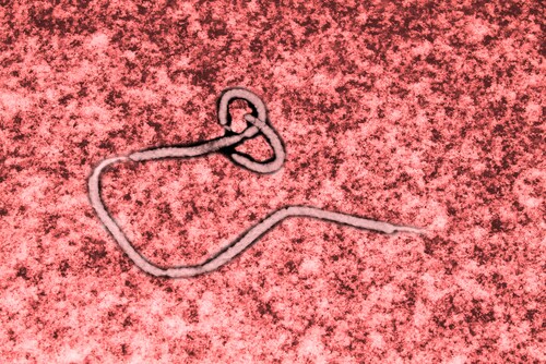 Ebola virus seen under a microscope with epidemic sign. Image: Studio_3321/Shutterstock.com.