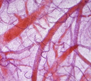 Blood vessels under microscope. Image: Anna Jurkovska/Shutterstock.com.