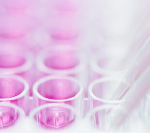 Pipetting pink liquid into multi-well plate. Image: Andrii Slonchak/Shutterstock.com.