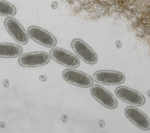 Microscopic of ecoli bacteria, Escherichia coli bacteria, Listeria monocytogenes. Image: Nixx Photography/Shutterstock.com.