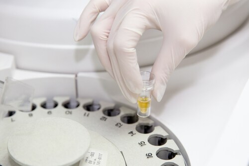 Urine samples in cetrifuge. Image: PhotoSkech/Shutterstock.com 