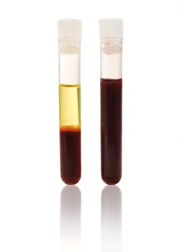 blood and plasma in a tube