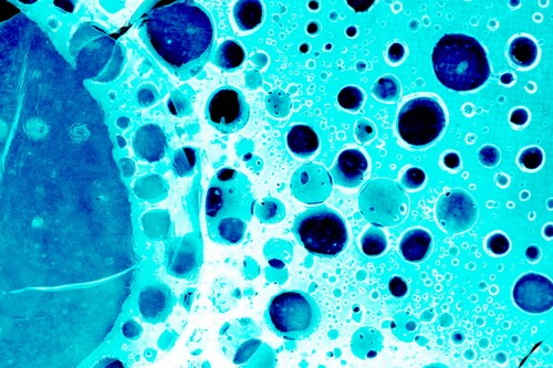 Cancer cells. Image: Shebeko/Shutterstock.com