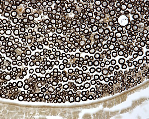 Myelin sheath. Image: Jose Luis Calvo/Shutterstock.com