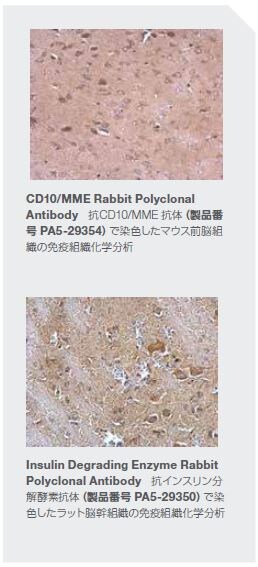 CD10/MME Rabbit Polyclonal Antibody