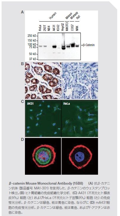 β-catenin Mouse Monoclonal Antibody (15B8)　