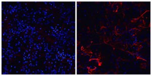 マウス皮質グリア共培養（32DIV）の染色画像