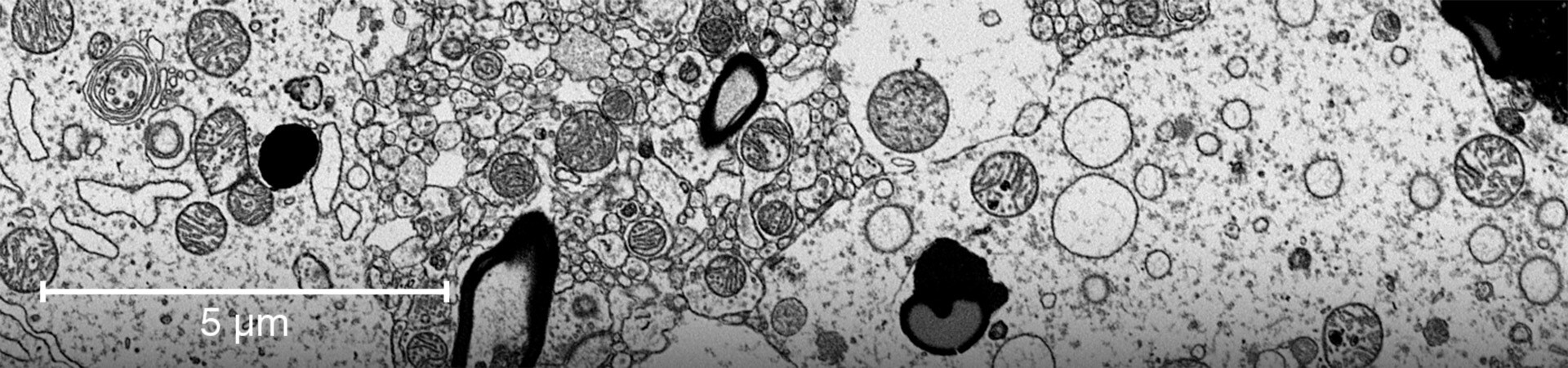 Postmortem brain tissue imaging sheds light on cognitive function in life