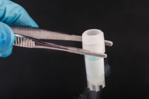 Cryosample for long-term storage. Sperm and stem cells bank storage. Image: Elena Pavlovich/Shutterstock.com.