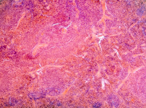 Micrograph of pancreas tissue, typical pancreatic tissue in the jejunum tissue. Image: Pan Xunbin/Shutterstock.com.