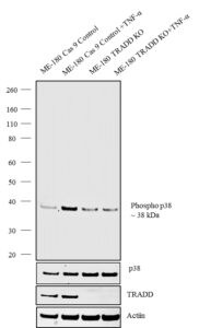 Western blot analysis of phosphorylation of p38 