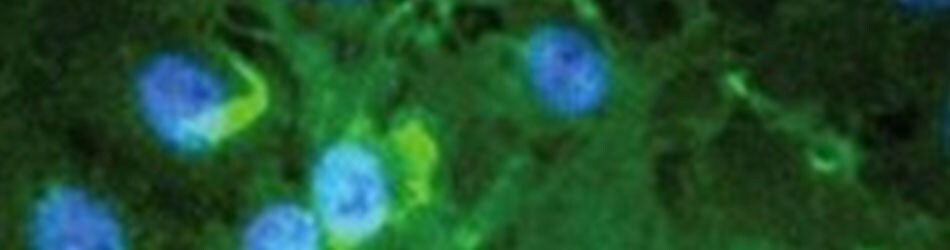 Labeling and detection reagents Labeling and detection reagents