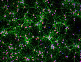 Neurons cultivated B-27 Plus Supplement and neurobasal media Microscopic image of neurons cultivated B-27 Plus Supplement and neurobasal media