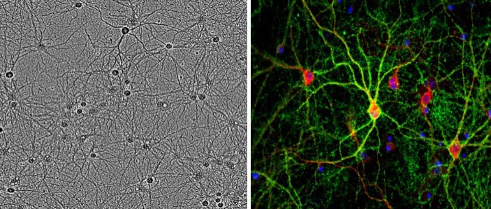 Primary cortical neurons cultured in B-27 Plus Supplement Phase contrast microscopic image of primary cortical neurons