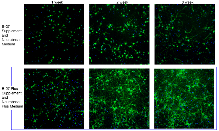 Neurons cultured in B-27 Supplement and Neurobasal Medium versus B-27 Supplement and Neurobasal Plus Medium Neurons cultured in B-27 Supplement and Neurobasal Medium versus B-27 Supplement and Neurobasal Plus Medium