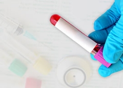 blood sample blood sample