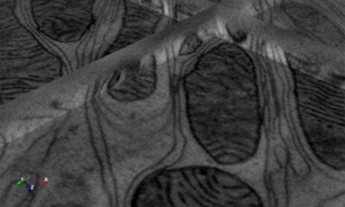 Tomography post-alignment and reconstruction module Tomography post-alignment and reconstruction module