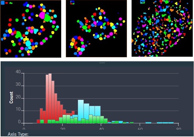 Gold nanoparticle analysis performed with Avizo Software. Gold nanoparticle analysis performed with Avizo Software.