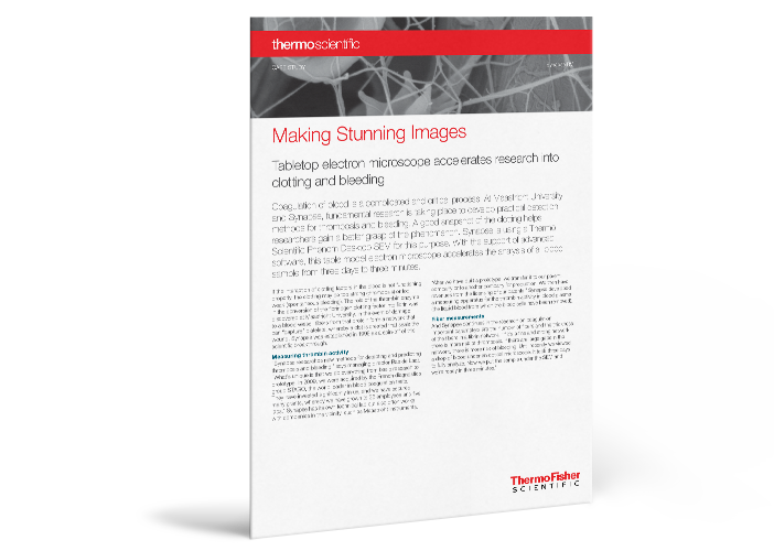 Case Study: Measuring Thrombin Activity at Synapse with the Desktop SEM Case Study: Measuring Thrombin Activity at Synapse with the Desktop SEM