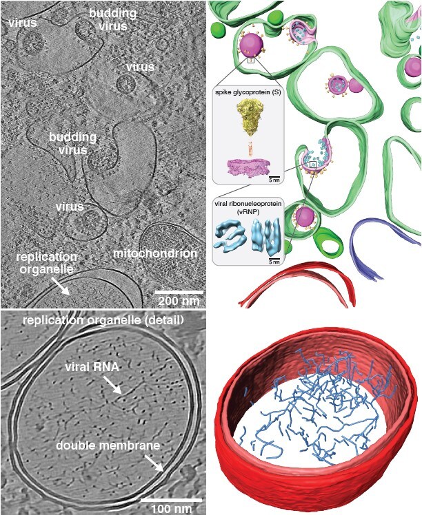 Two reconstructed tomograms showing SARS-CoV-2 assembly at the ERGIC (top) and the viral replication organelles showing viral RNA (bottom). Two reconstructed tomograms showing SARS-CoV-2 assembly at the ERGIC (top) and the viral replication organelles showing viral RNA (bottom).