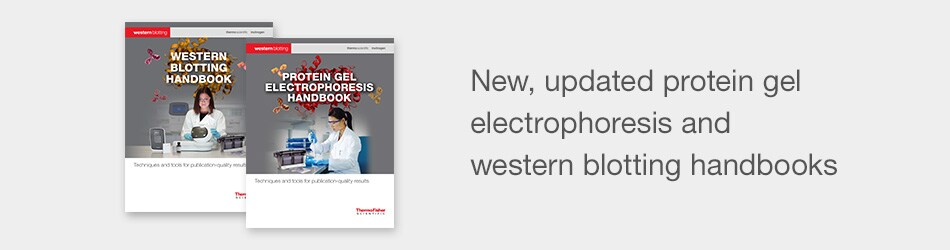protein-gel-electrophoresis-western-blotting-handbooks-950x250 protein-gel-electrophoresis-western-blotting-handbooks-950x250