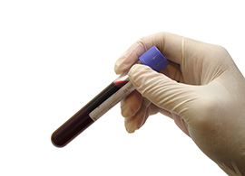Scientist handling a vial of blood Scientist handling a vial of blood