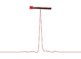 A vial of blood and a chromatogram A vial of blood and a chromatogram