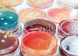 Change the way you control quality Change the way you control quality