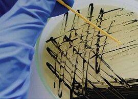 Biochemical identification software downloads Biochemical identification software downloads