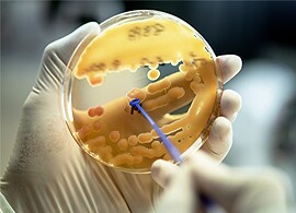 Ensuring detection of novel antimicrobial resistant strains – look out for Carbapenemases Ensuring detection of novel antimicrobial resistant strains – look out for Carbapenemases