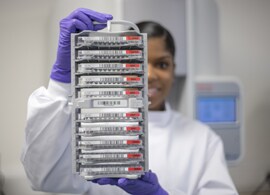 Anaerobe testing Anaerobe testing