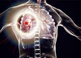 Support your immunocompromised patients Support your immunocompromised patients