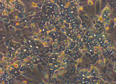 HepaRG spheroid microscopic view of a HepaRG spheroid