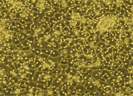 Plateable cells microscopic view of plateable hepatocytes
