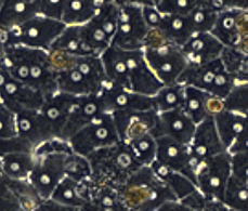 Hepatocytes Hepatocytes