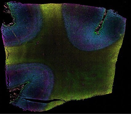 Stained human brain tissue using ReadyLabel Antibody Labeling Kits Fluorescent microscopy image of human brain tissue