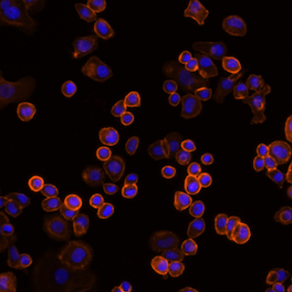 Zenon Alexa Fluor Plus Microscope image of fluorescently labeled SKBR3 Cells