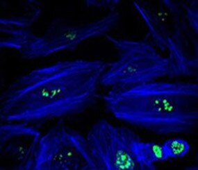 Zip Rapid Antibody Labeling Kits Zip Rapid Antibody Labeling Kits