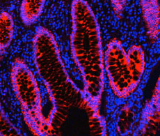 000006-IHC-cytokeratin-DyLight-594-streptavidin-230 000006-IHC-cytokeratin-DyLight-594-streptavidin-230