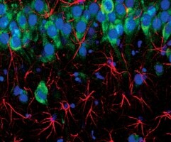 Custom hybridoma and antibody production Custom hybridoma and antibody production