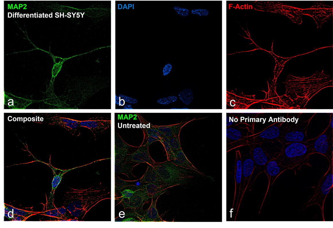 Relative expression validation of MAP2 in SH-SY5Y cells. 6 fluorescent images showing the immunofluorescence analysis of MAP2 in SH-SY5Y cells with untreated and controls included.