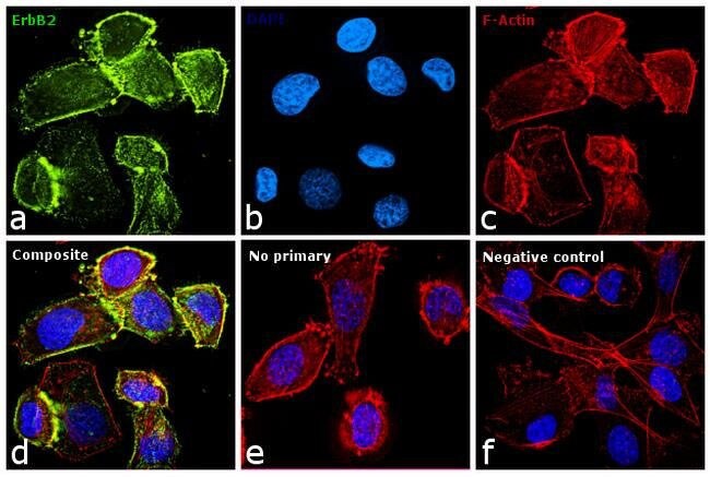 Relative expression validation of Her2 antibody demonstrated by immunofluorescence Relative expression validation of Her2 antibody demonstrated by immunofluorescence