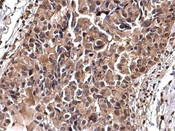 Immunohistochemical analysis of gamma tubulin Immunohistochemical analysis of gamma tubulin