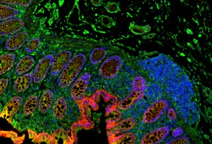 Tissue IHC Fluorescent tissue image, displaying four color staining.